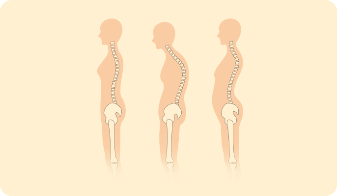 姿勢の改善を表現した画像
